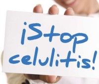 Acabar con la celulitis