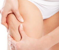 Cómo se forma la celulitis: La vida sedentaria