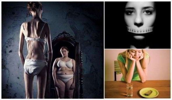 anorexia nerviosa causas y tratamientos