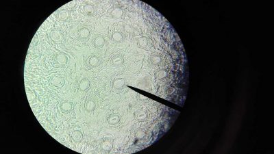 Célula mirada por microscopio.