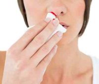 Remedios caseros para epistaxis y los granos